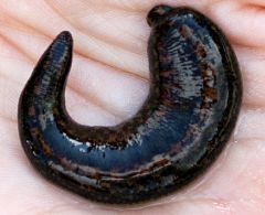 Mobile Therapiepraxis für Osteopathie und Blutegeltherapie