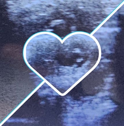 Wurfankündigung Februar 2024