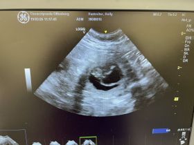 Wir erwarten Flat-Coated-Retriever Welpen !!